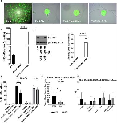 Emerging of a new CD3+CD31HCD184+ tang cell phenothype in Sjögren’s syndrome induced by microencapsulated human umbilical cord matrix-derived multipotent stromal cells